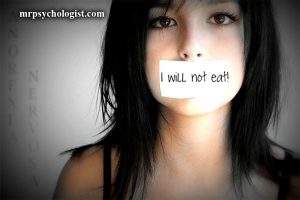بی‌اشتهایی عصبی، آنورکسیا نروزا یا Anorexia Nervosa
