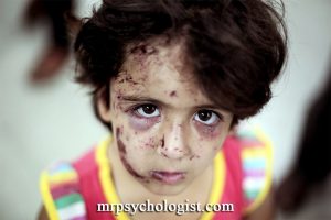 اختلال استرس پس از سانحه PTSD در کودکان
